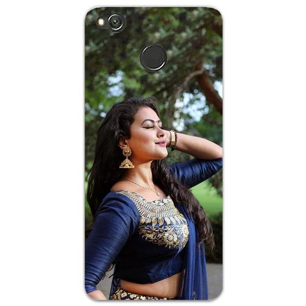 Custom Xiaomi Redmi 4 Mobile Phone Cover